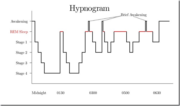 Hypnograma-Wikipedia